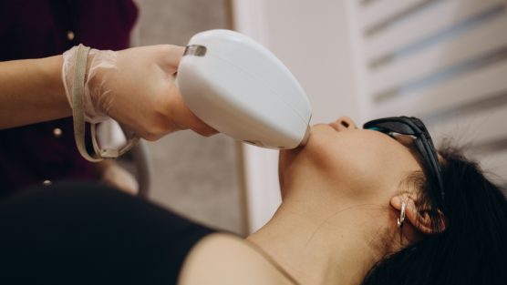 O ultrassom microfocado pode ser utilizado para tratar cicatrizes?