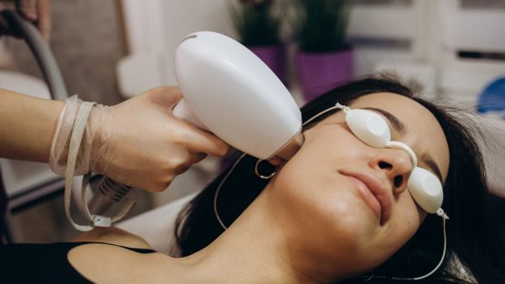 O ultrassom microfocado pode ser utilizado para tratar estrias?
