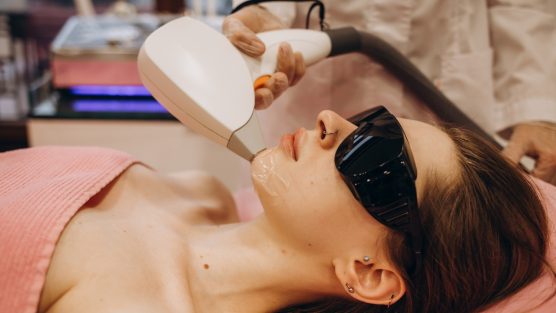 O ultrassom microfocado trata flacidez na região dos olhos?