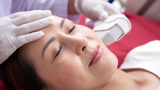 O Ultrassom Microfocado é seguro?