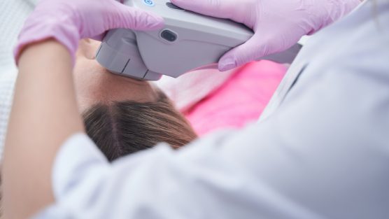 Qual é o preço do ultrassom microfocado?