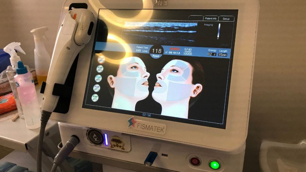 Qual é a idade mínima para fazer ultrassom microfocado?